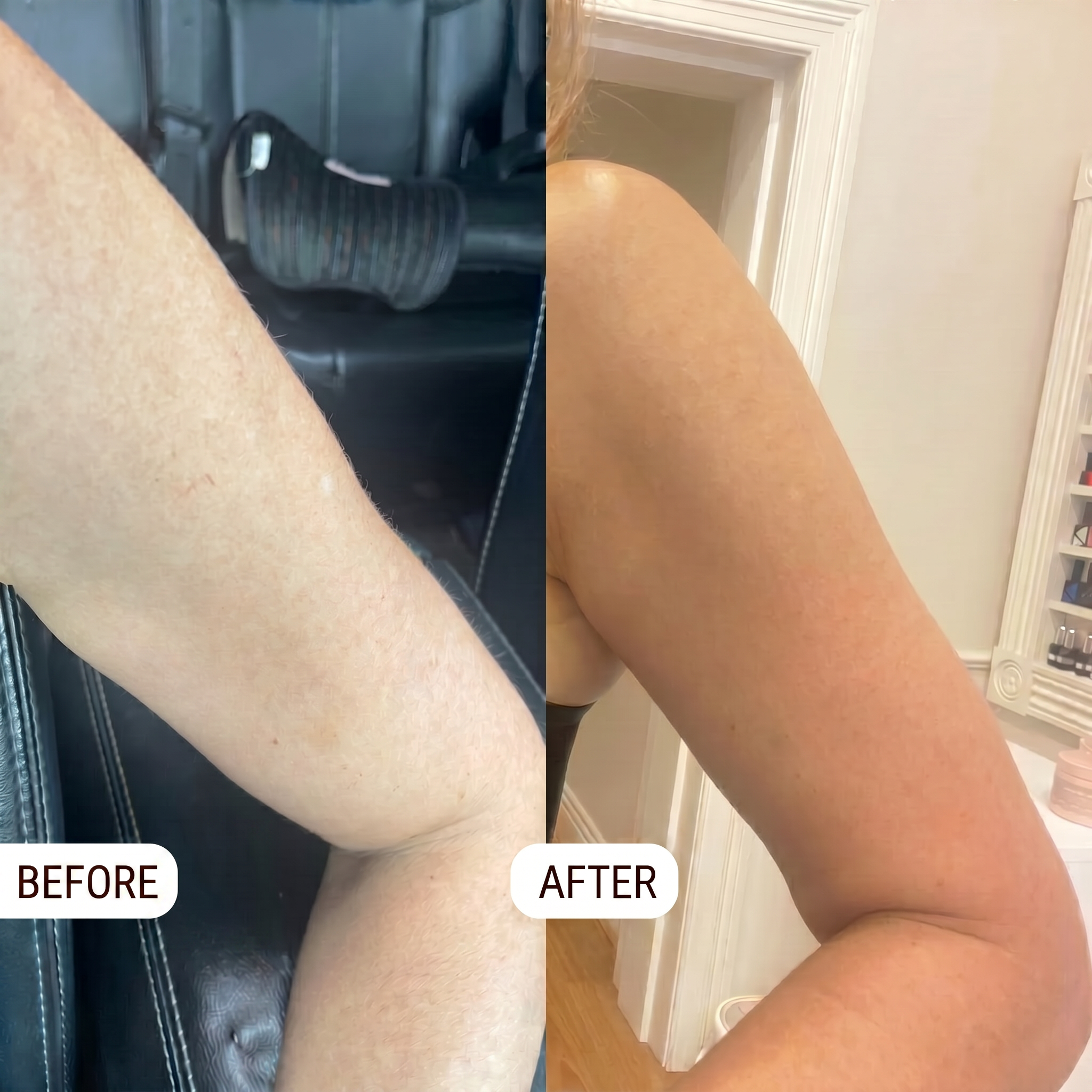 Self Tanning Foam